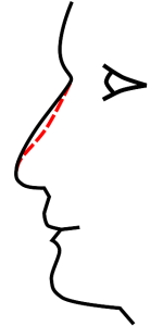 20140822